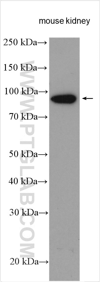 Western Blot (WB) analysis of various lysates using NVL Polyclonal antibody (16970-1-AP)