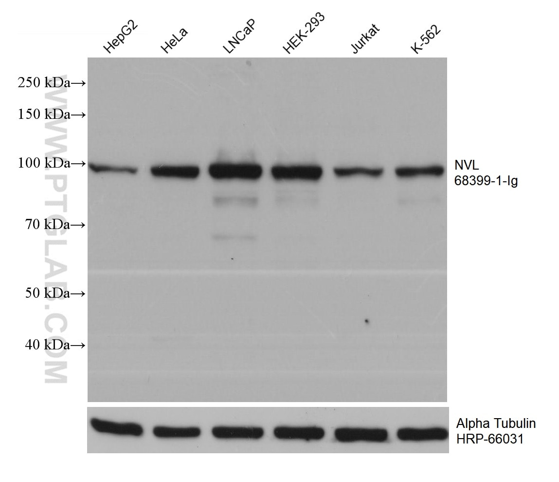 Western Blot (WB) analysis of various lysates using NVL Monoclonal antibody (68399-1-Ig)