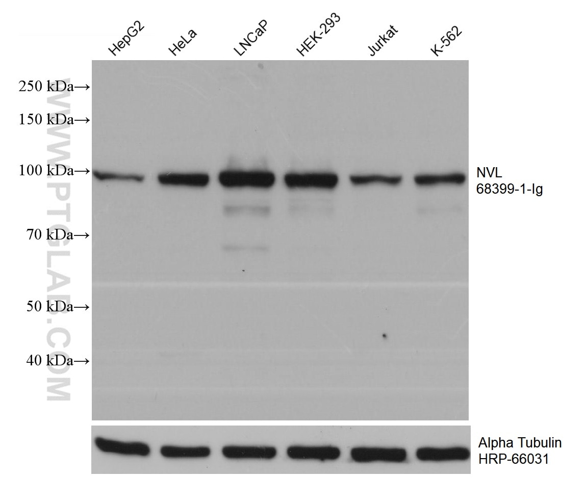 WB analysis using 68399-1-Ig