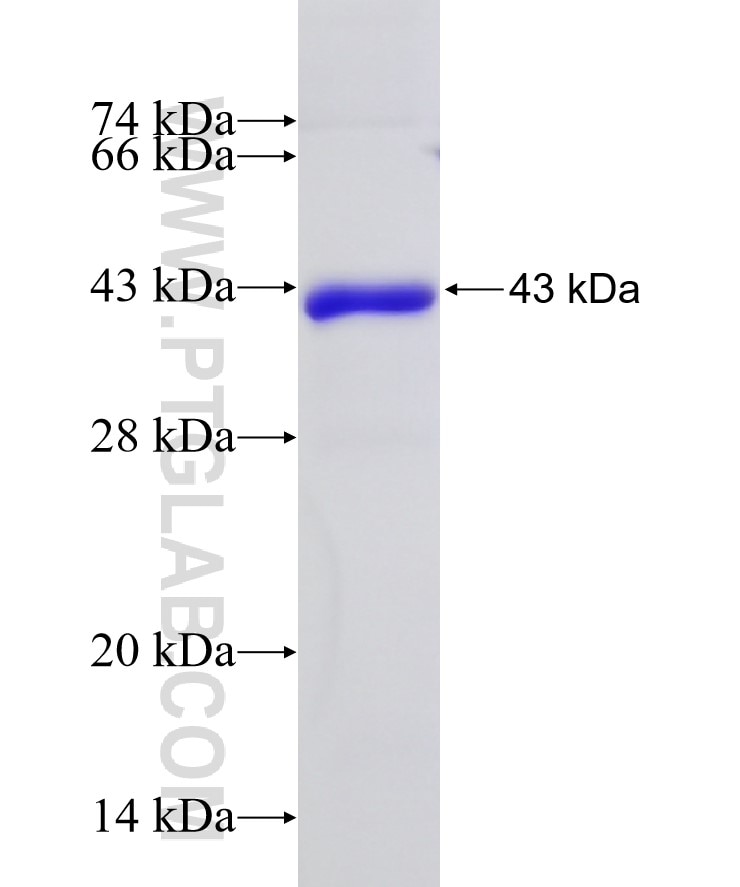 NVL fusion protein Ag9321 SDS-PAGE