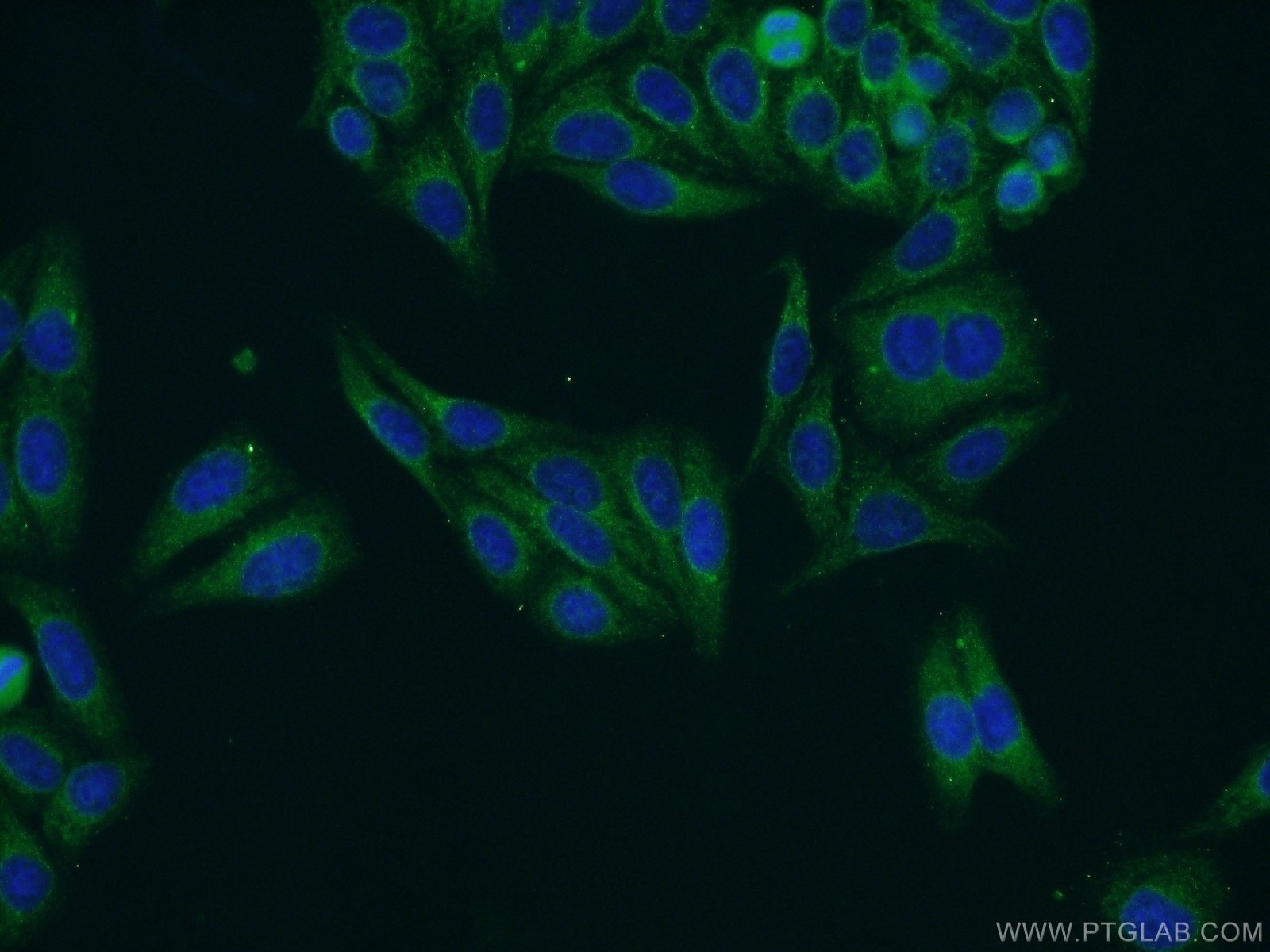 Immunofluorescence (IF) / fluorescent staining of HepG2 cells using NWD1 Polyclonal antibody (25025-1-AP)