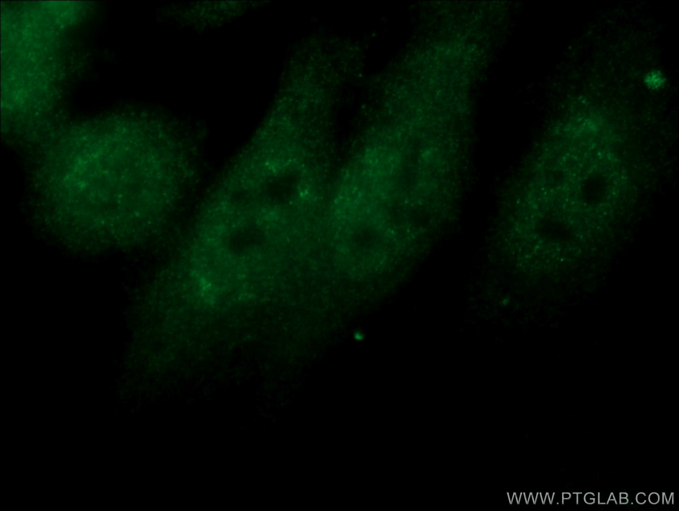 Immunofluorescence (IF) / fluorescent staining of HepG2 cells using NXF1 Polyclonal antibody (10328-1-AP)