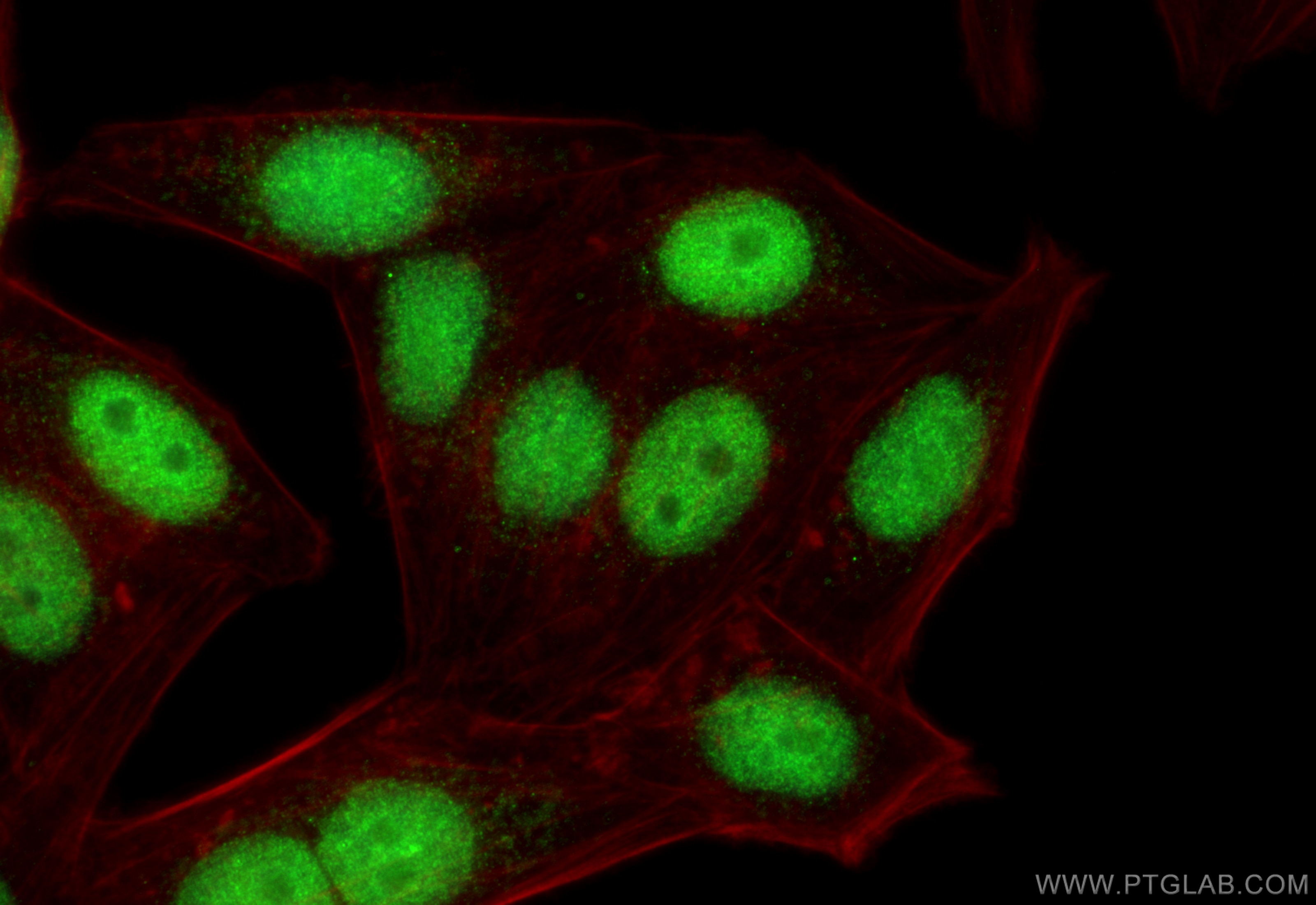 Immunofluorescence (IF) / fluorescent staining of HepG2 cells using NXF1 Polyclonal antibody (10328-1-AP)