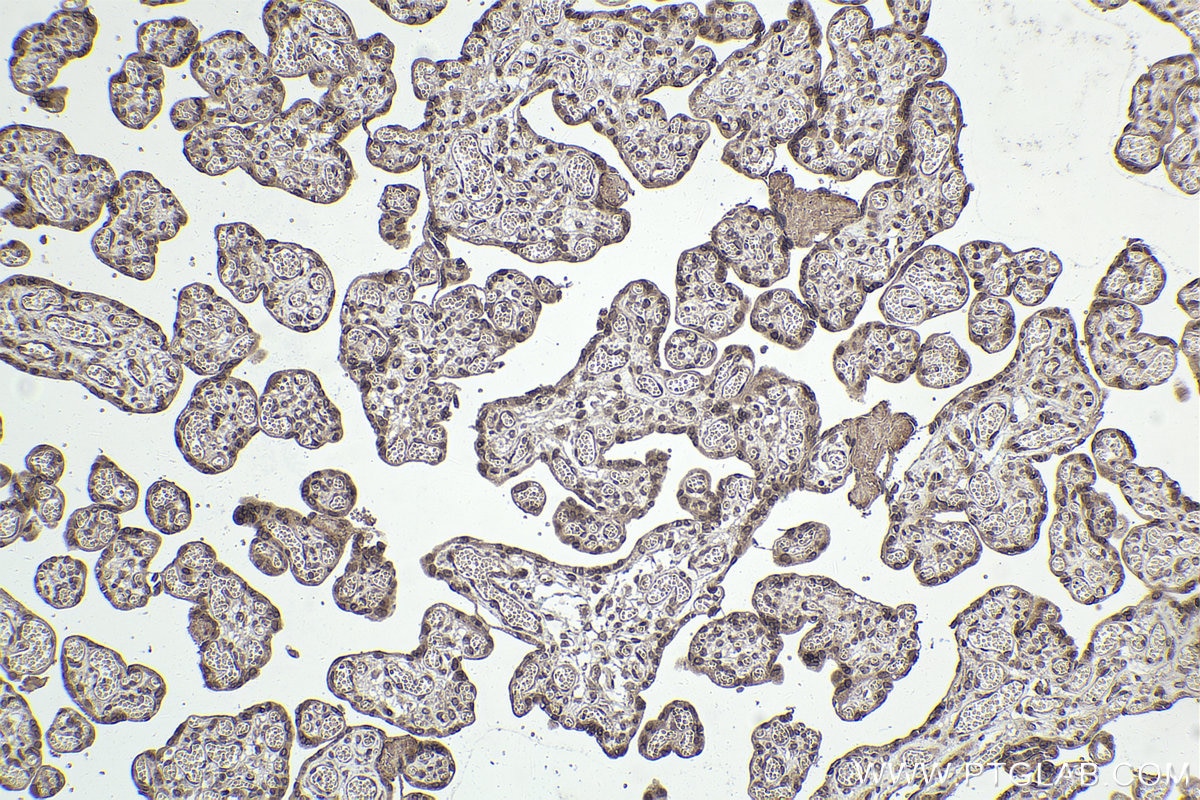 IHC staining of human placenta using 10328-1-AP Immunohistochemistry (IHC) staining of human placenta tissue using NXF1 Polyclonal antibody (10328-1-AP)