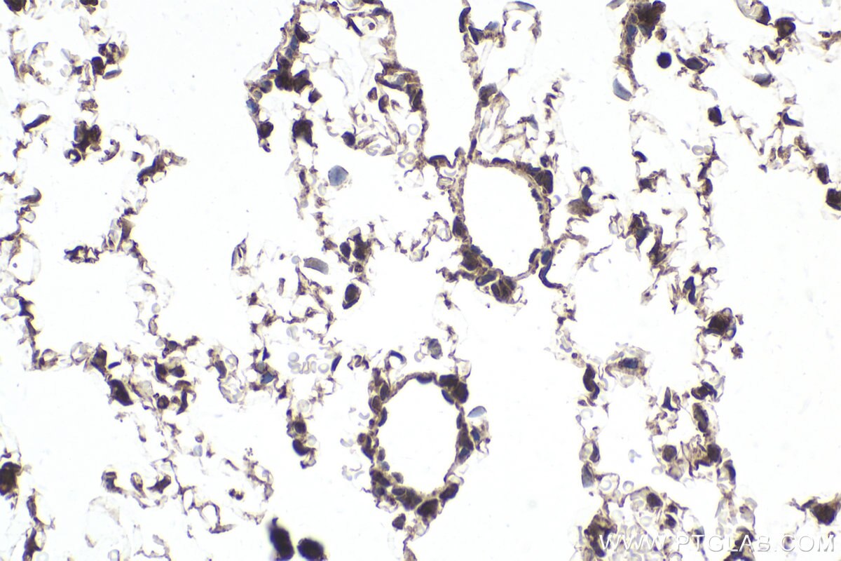 IHC staining of rat lung using 10328-1-AP Immunohistochemistry (IHC) staining of rat lung tissue using NXF1 Polyclonal antibody (10328-1-AP)