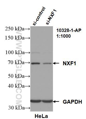 Western Blot (WB) analysis of HeLa cells using NXF1 Polyclonal antibody (10328-1-AP)