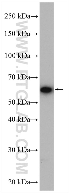 Western Blot (WB) analysis of HeLa cells using NXF1 Polyclonal antibody (10328-1-AP)