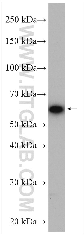 WB analysis of HeLa using 10328-1-AP