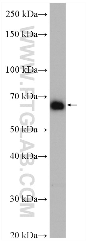 Western Blot (WB) analysis of HepG2 cells using NXF1 Polyclonal antibody (10328-1-AP)