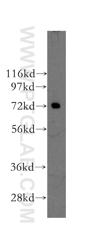 Western Blot (WB) analysis of mouse testis tissue using NXF2 Polyclonal antibody (12185-1-AP)