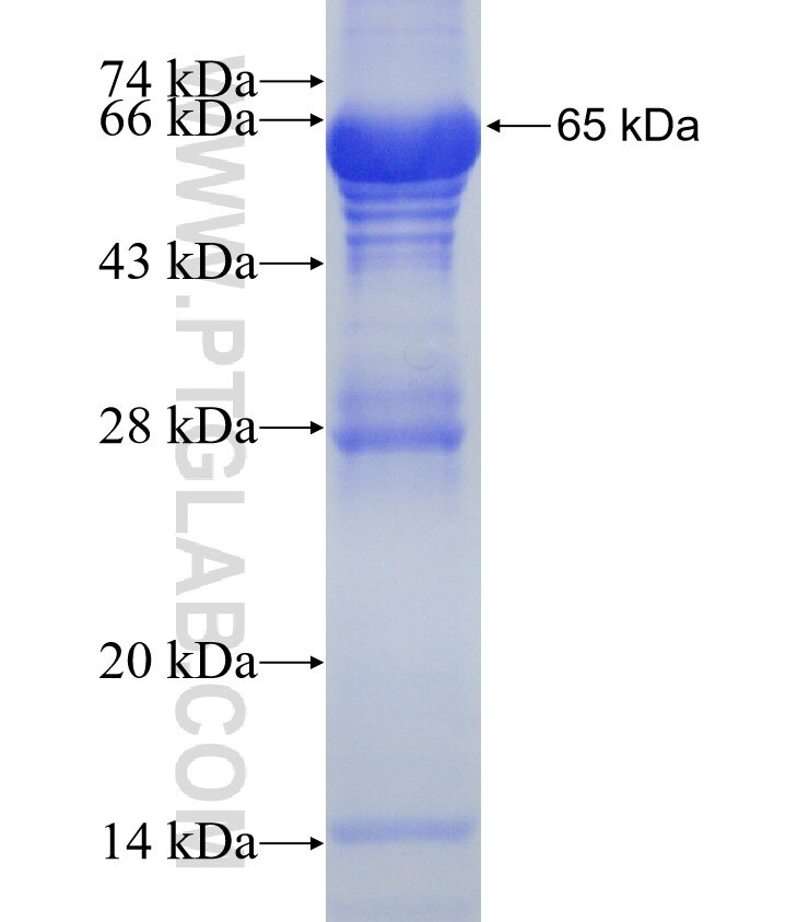 NXF2 fusion protein Ag2841 SDS-PAGE