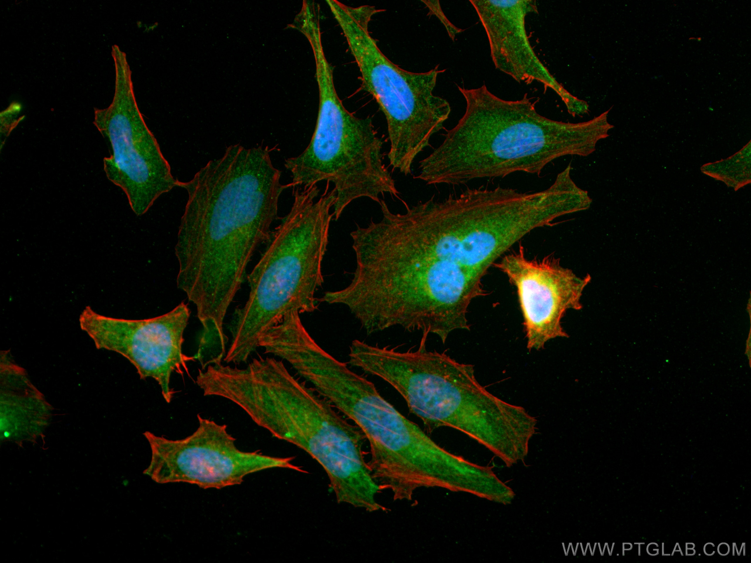 Immunofluorescence (IF) / fluorescent staining of HeLa cells using NXN Polyclonal antibody (16128-1-AP)