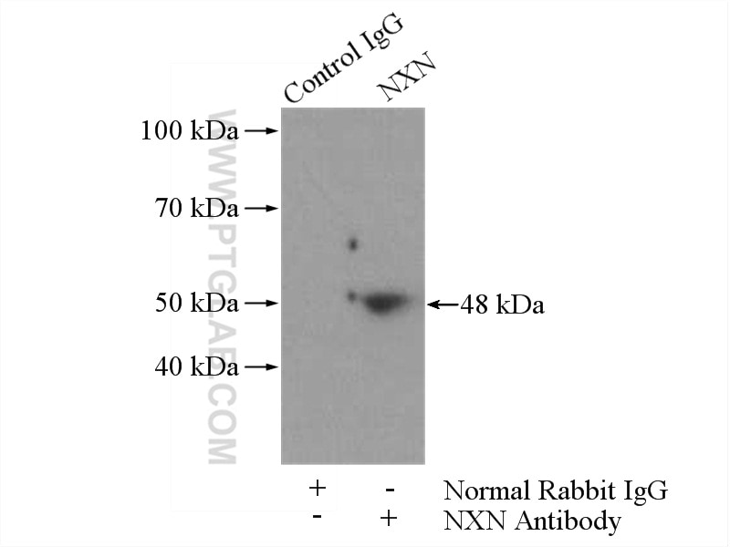 Immunoprecipitation (IP) experiment of HeLa cells using NXN Polyclonal antibody (16128-1-AP)