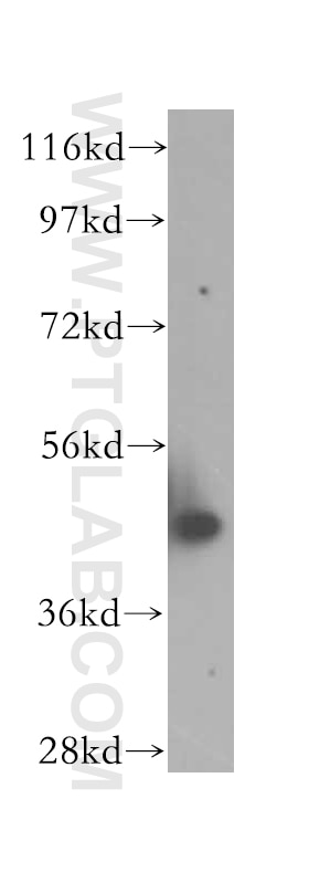 Western Blot (WB) analysis of HeLa cells using NXN Polyclonal antibody (16128-1-AP)