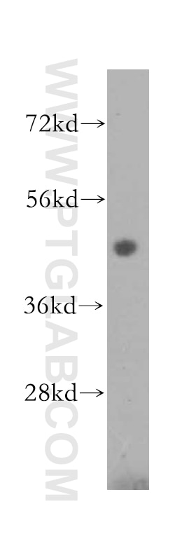 Western Blot (WB) analysis of human heart tissue using NXN Polyclonal antibody (16128-1-AP)