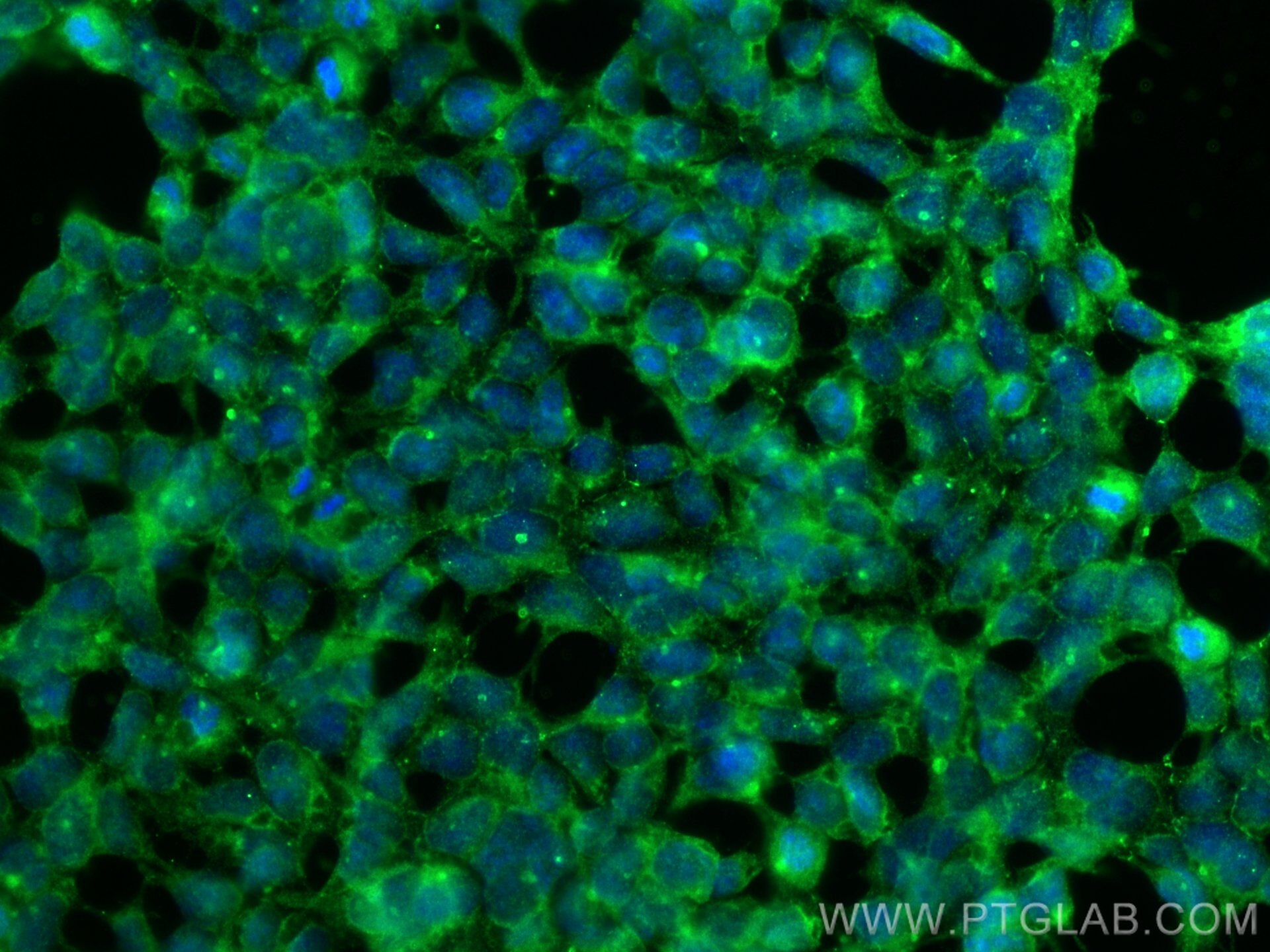 Immunofluorescence (IF) / fluorescent staining of HEK-293 cells using NXN Monoclonal antibody (66603-1-Ig)