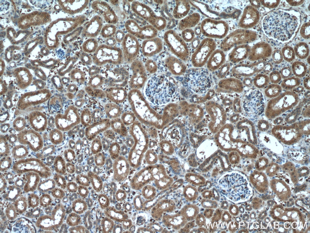 Immunohistochemistry (IHC) staining of human kidney tissue using NXN Monoclonal antibody (66603-1-Ig)