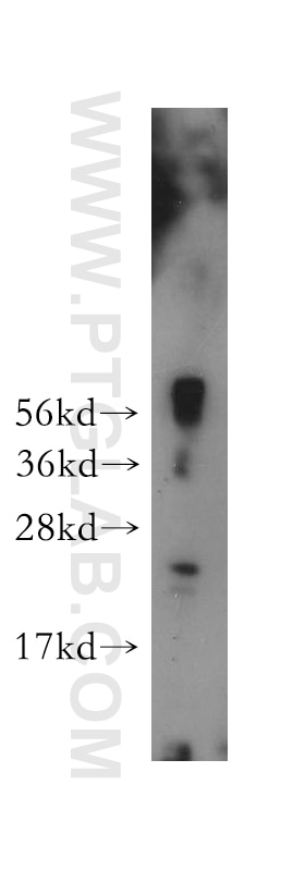Western Blot (WB) analysis of HeLa cells using TXNL6 Polyclonal antibody (11203-1-AP)