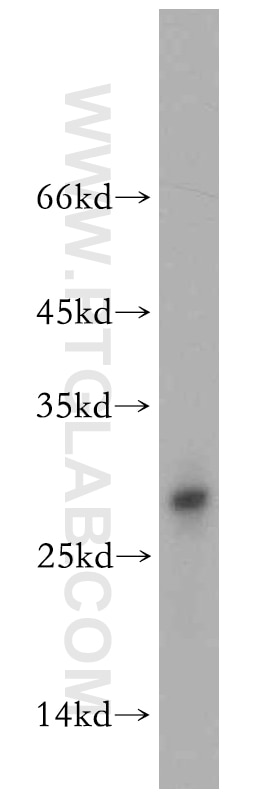 Western Blot (WB) analysis of mouse brain tissue using TXNL6 Polyclonal antibody (11203-1-AP)