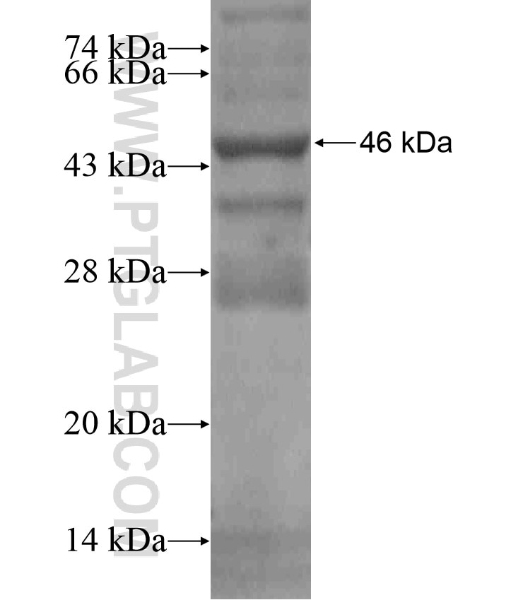 NXNL2 fusion protein Ag18292 SDS-PAGE NXNL2 fusion protein Ag18292 SDS-PAGE