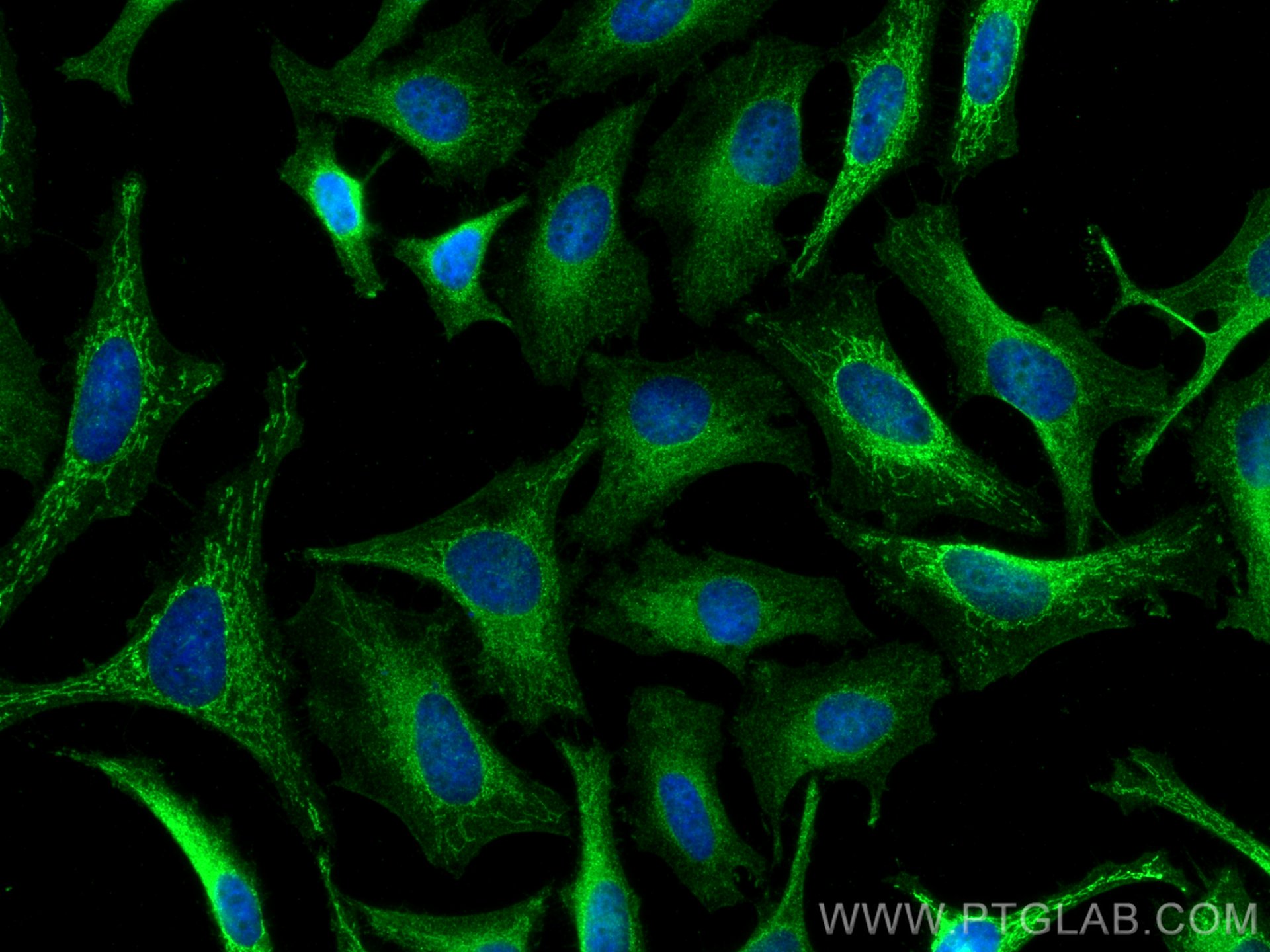 Immunofluorescence (IF) / fluorescent staining of HeLa cells using NXT1 Monoclonal antibody (67680-1-Ig)