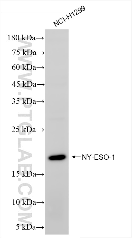Western Blot (WB) analysis of NCI-H1299 cells using NY-ESO-1 Recombinant antibody (85355-1-RR)