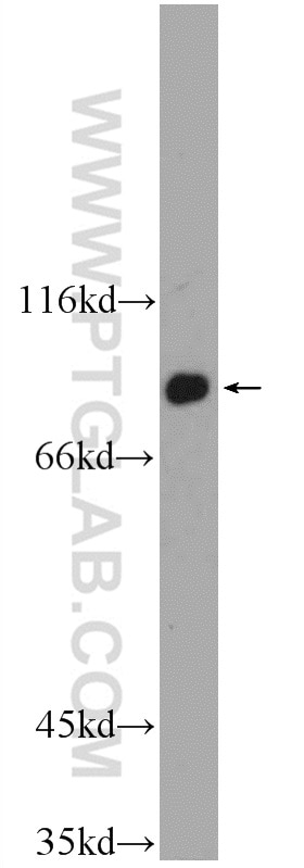 Western Blot (WB) analysis of mouse brain tissue using NYAP2 Polyclonal antibody (25108-1-AP)