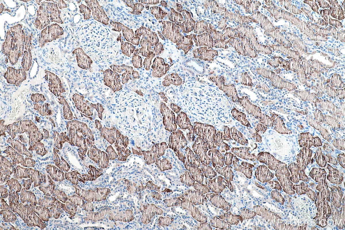 Immunohistochemistry (IHC) staining of human kidney tissue using SLC13A3 Polyclonal antibody (26184-1-AP)