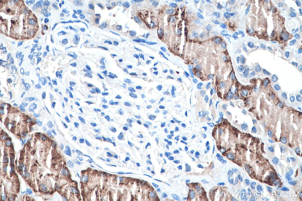 Immunohistochemistry (IHC) staining of human kidney tissue using SLC13A3 Polyclonal antibody (26184-1-AP)