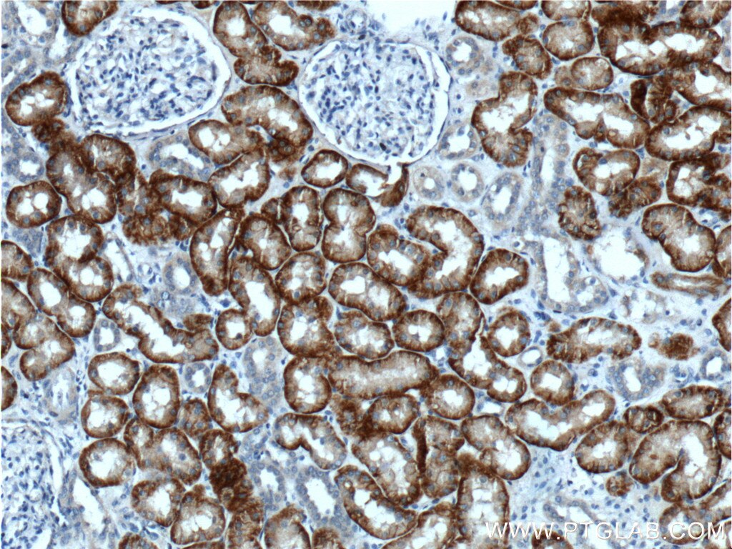 IHC staining of human kidney using 26184-1-AP