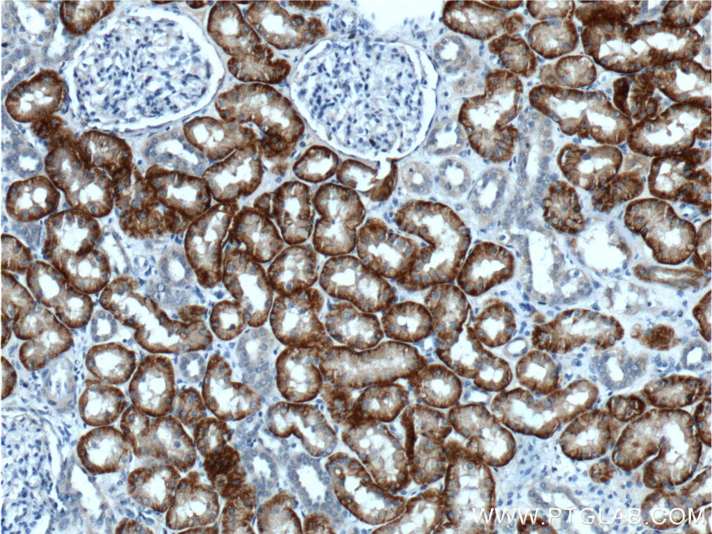 Immunohistochemistry (IHC) staining of human kidney tissue using SLC13A3 Polyclonal antibody (26184-1-AP)