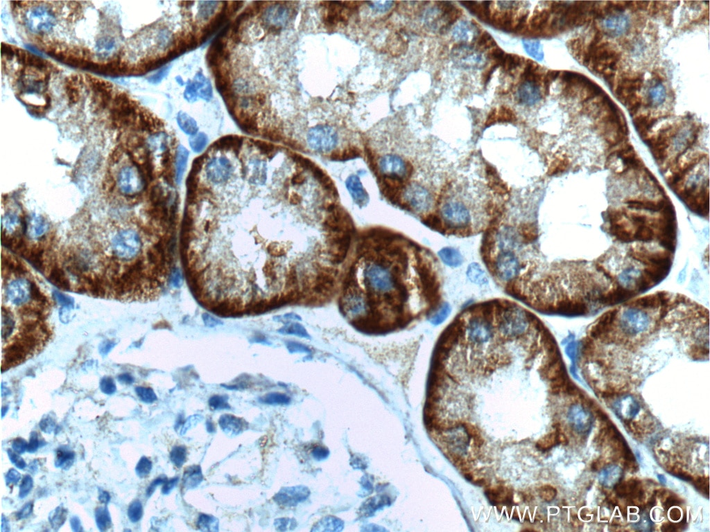 Immunohistochemistry (IHC) staining of human kidney tissue using SLC13A3 Polyclonal antibody (26184-1-AP)