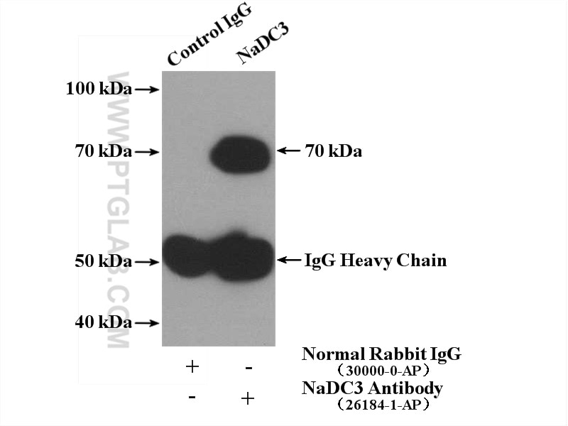 Immunoprecipitation (IP) experiment of mouse kidney tissue using SLC13A3 Polyclonal antibody (26184-1-AP)