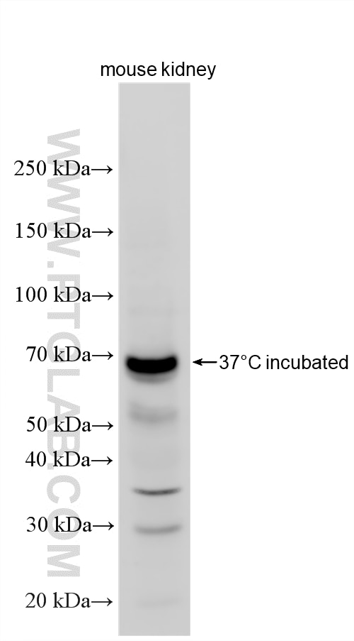 Western Blot (WB) analysis of various lysates using SLC13A3 Polyclonal antibody (26184-1-AP)