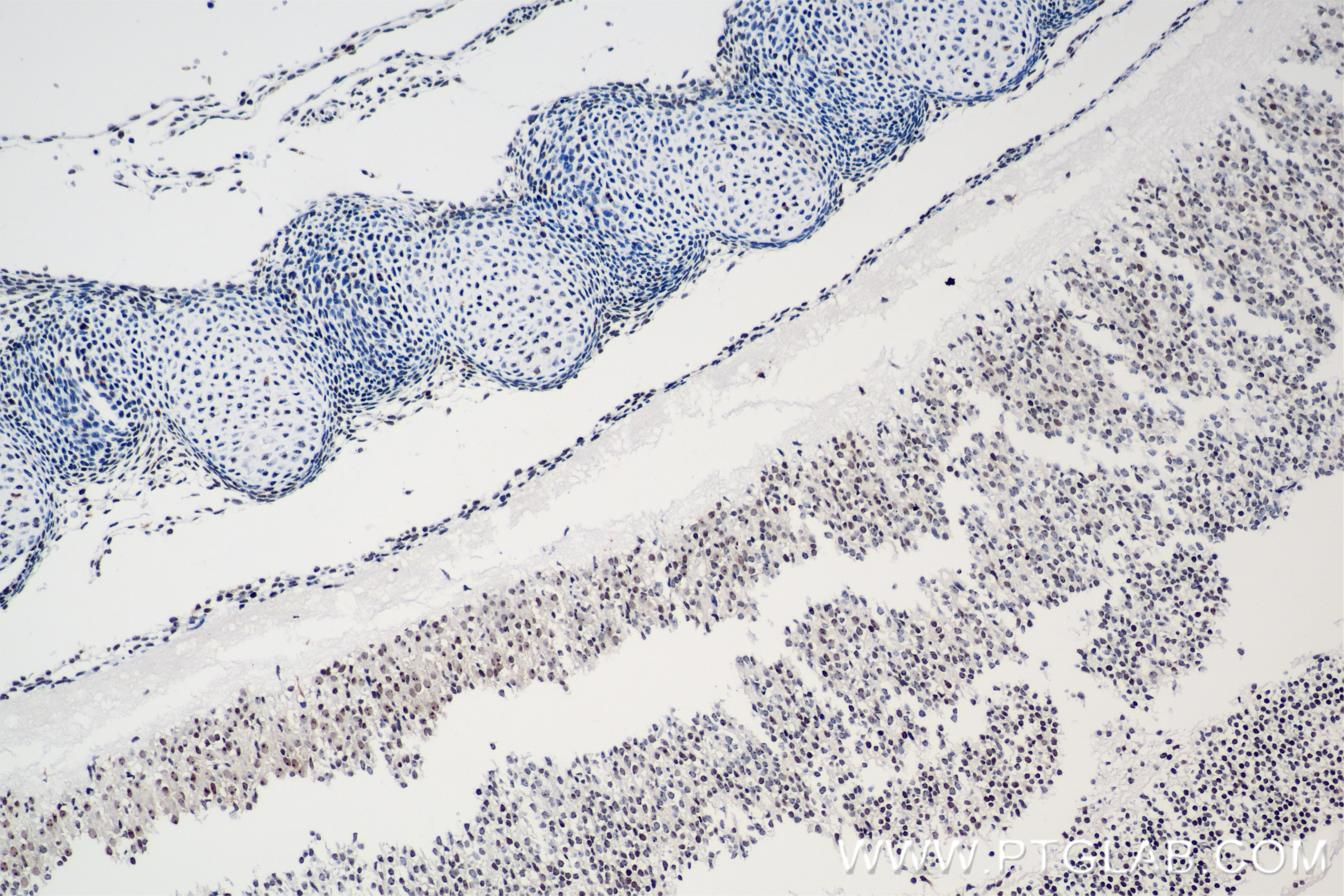 Immunohistochemistry (IHC) staining of mouse embryo tissue using Nanog Recombinant antibody (80210-13-RR)