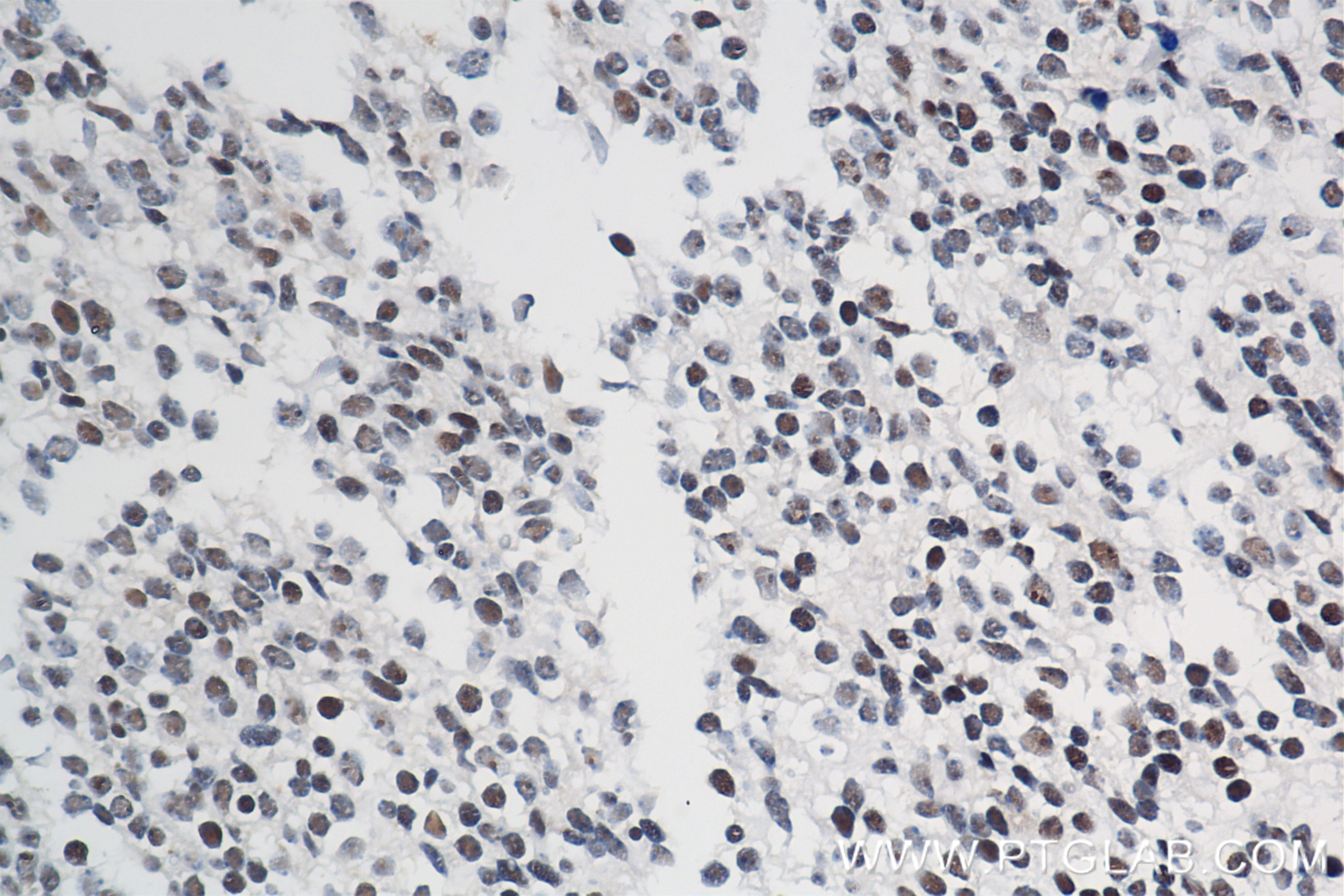 Immunohistochemistry (IHC) staining of mouse embryo tissue using Nanog Recombinant antibody (80210-13-RR)