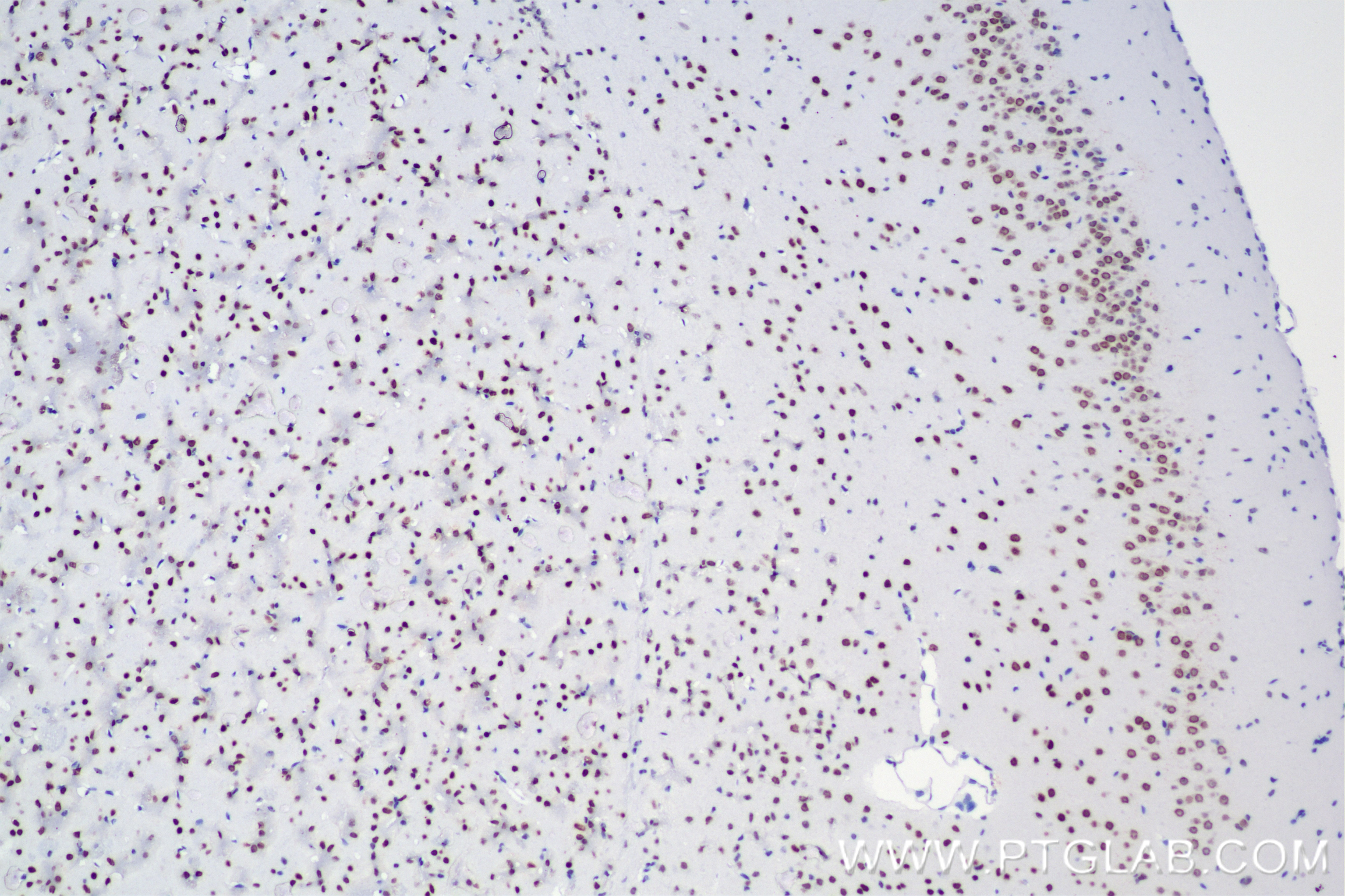 Immunohistochemistry (IHC) staining of mouse brain tissue using Nanog Recombinant antibody (80210-13-RR)