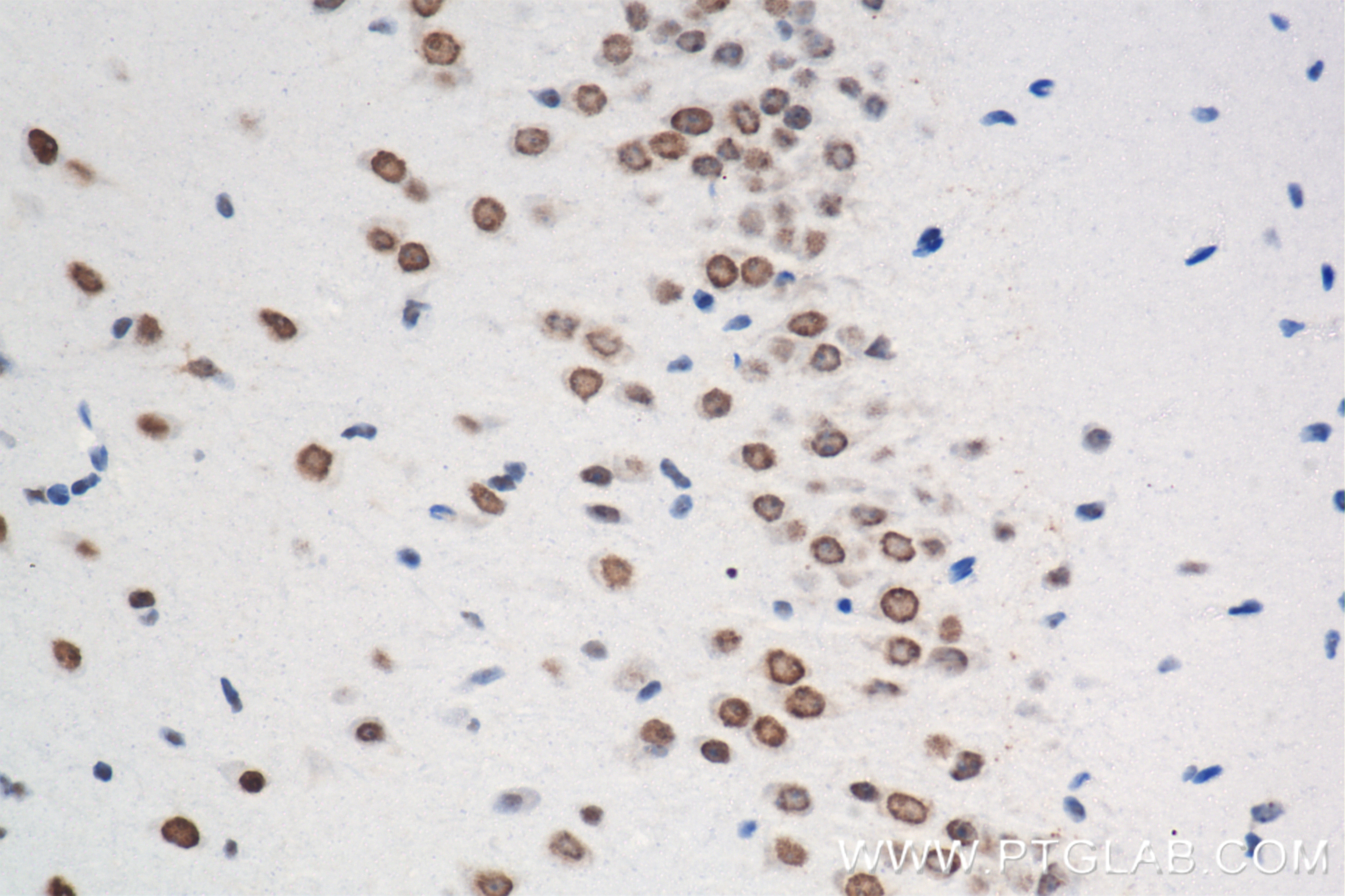 Immunohistochemistry (IHC) staining of mouse brain tissue using Nanog Recombinant antibody (80210-13-RR)