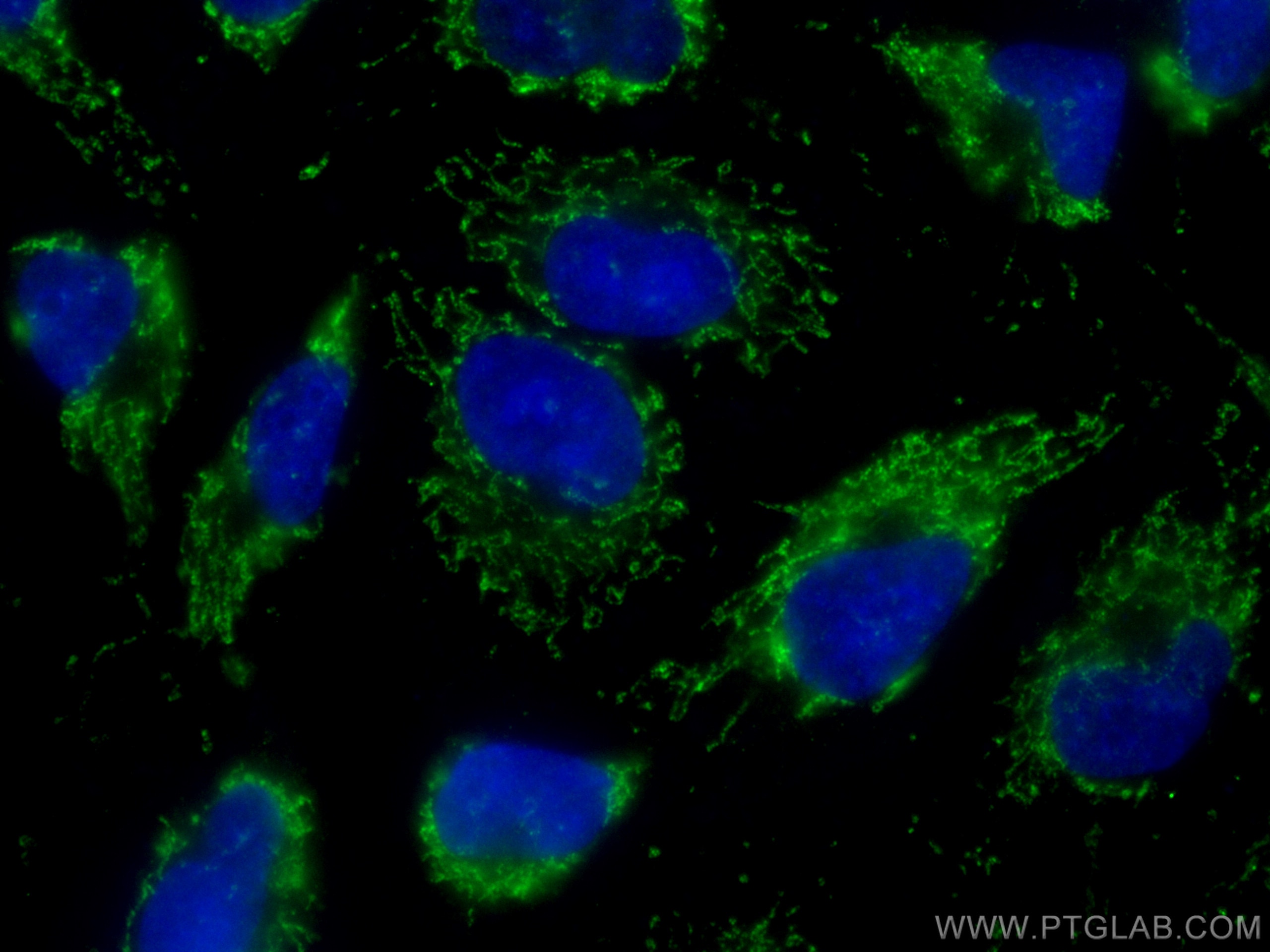 Immunofluorescence (IF) / fluorescent staining of HUVEC cells using CoraLite® Plus 488-conjugated Napsin A Monoclonal  (CL488-60259)