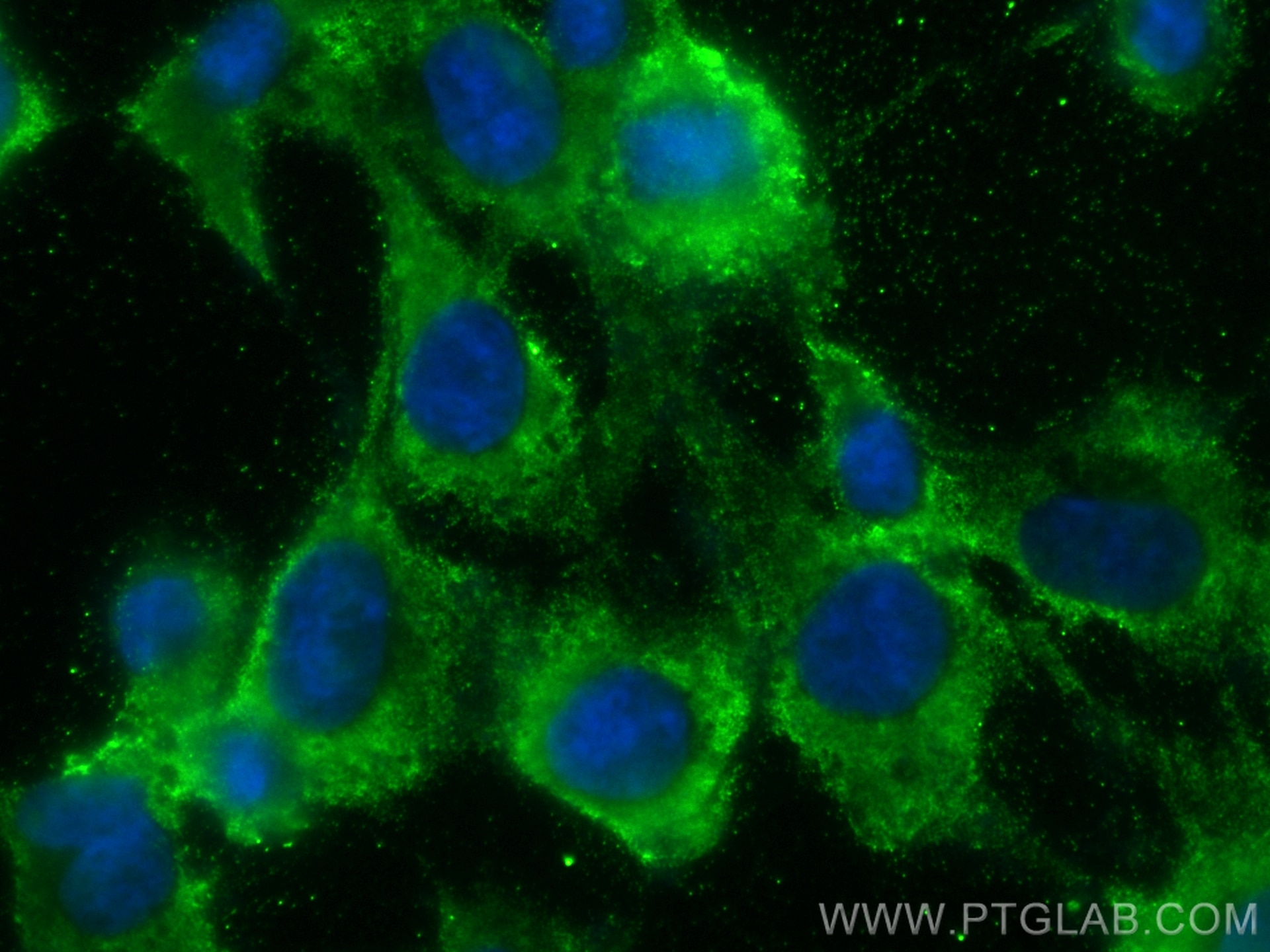 Immunofluorescence (IF) / fluorescent staining of HUVEC cells using CoraLite® Plus 488-conjugated Napsin A Monoclonal  (CL488-60259)