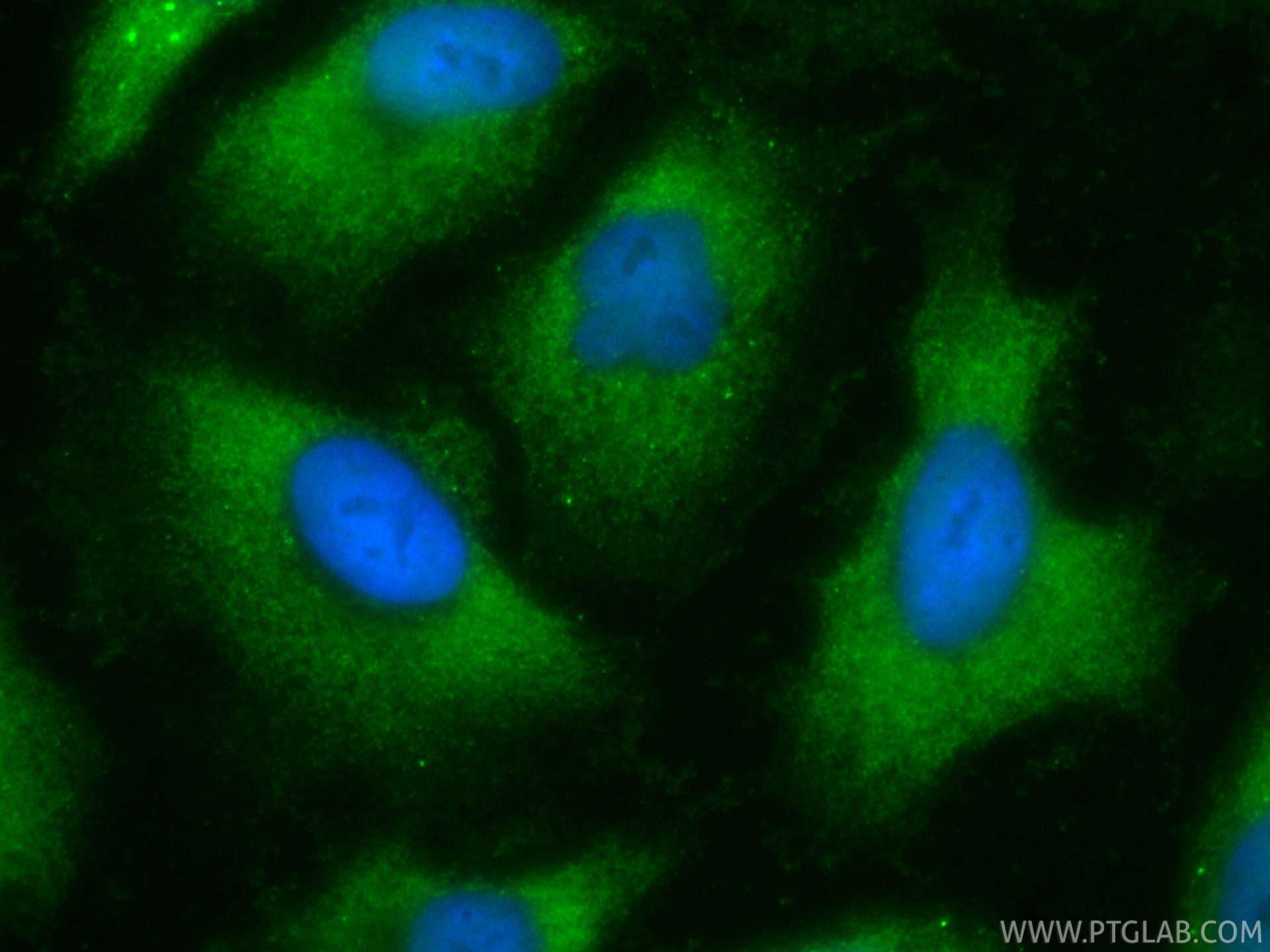 IF Staining of A549 using CL488-86052-4 Immunofluorescence (IF) / fluorescent staining of A549 cells using CoraLite® Plus 488-conjugated Napsin A Recombinant (CL488-86052-4)