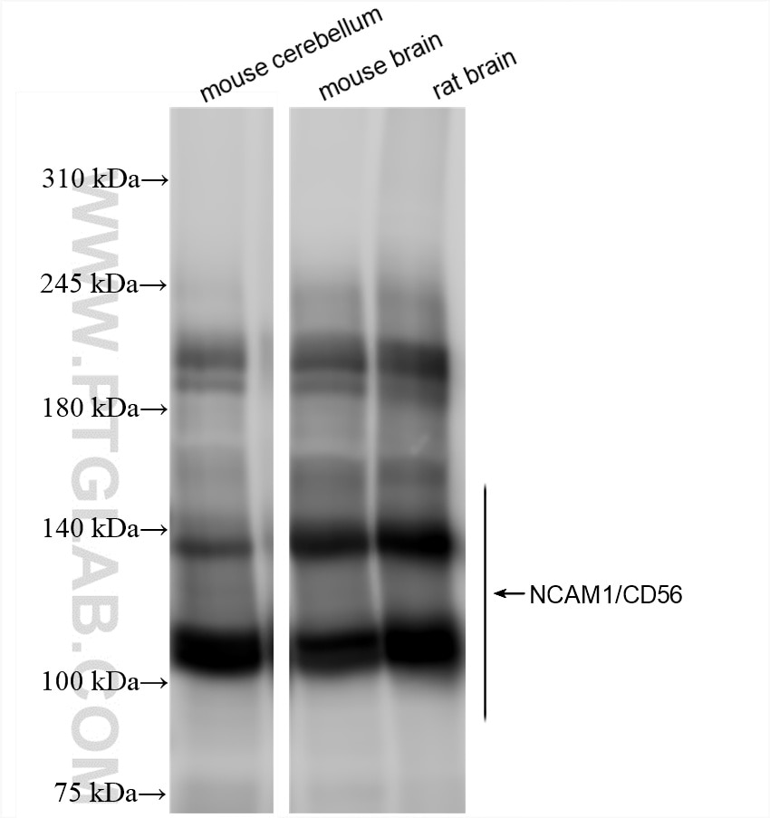 Western Blot (WB) analysis of various lysates using NCAM1/CD56 Recombinant antibody (83883-2-RR)