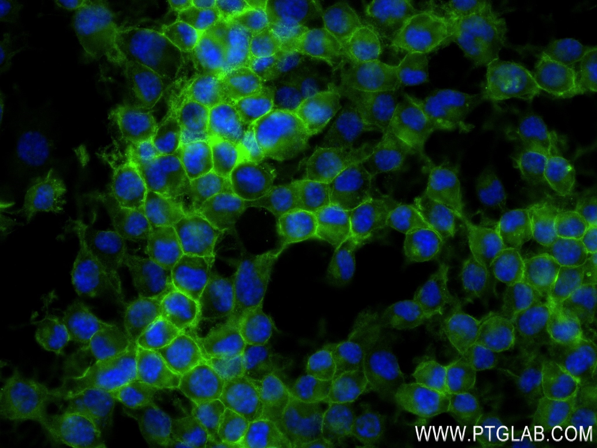 Immunofluorescence (IF) / fluorescent staining of Neuro-2a cells using NCAM1/CD56 Recombinant antibody (83883-5-RR)