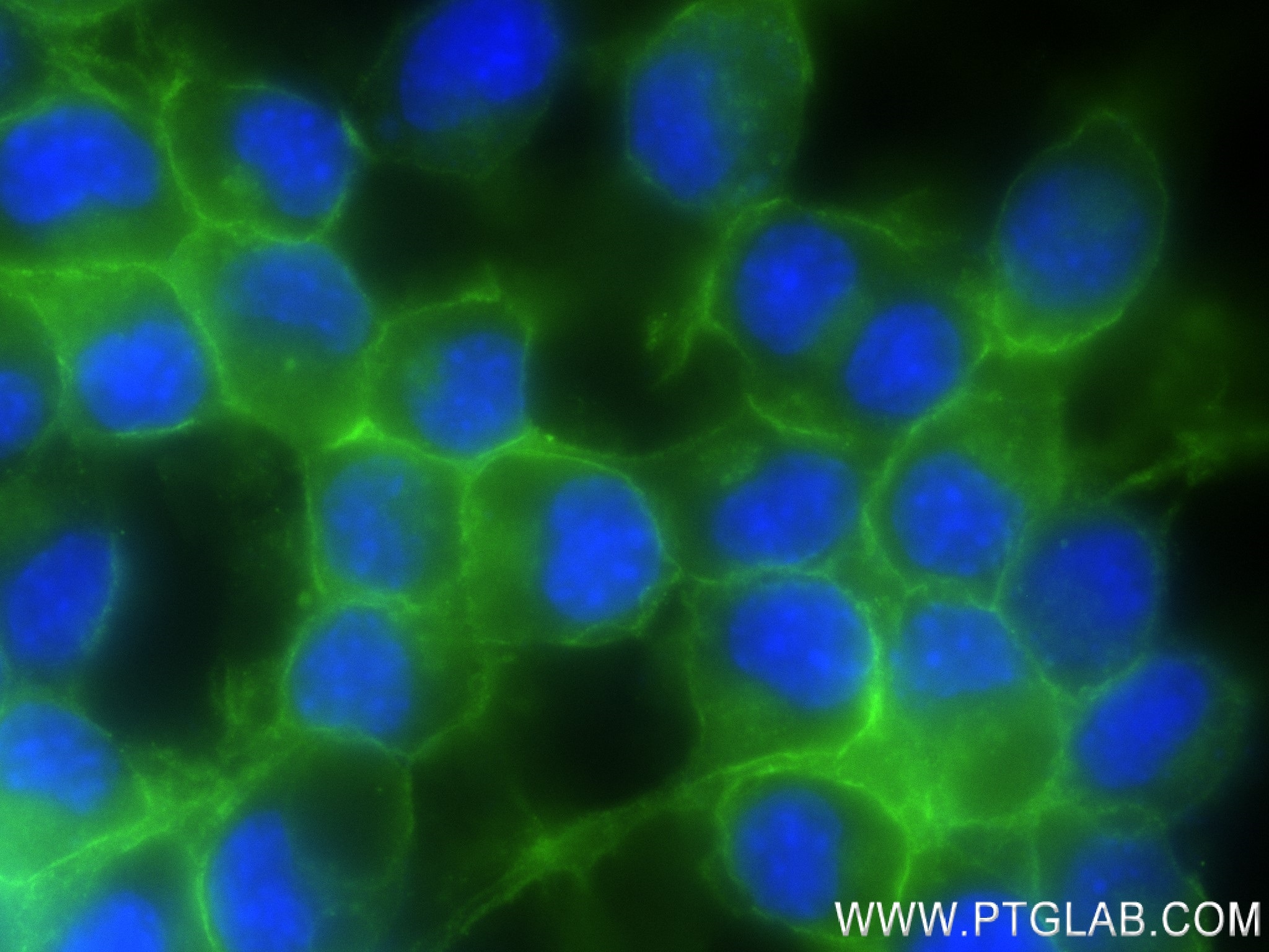 Immunofluorescence (IF) / fluorescent staining of Neuro-2a cells using NCAM1/CD56 Recombinant antibody (83883-5-RR)