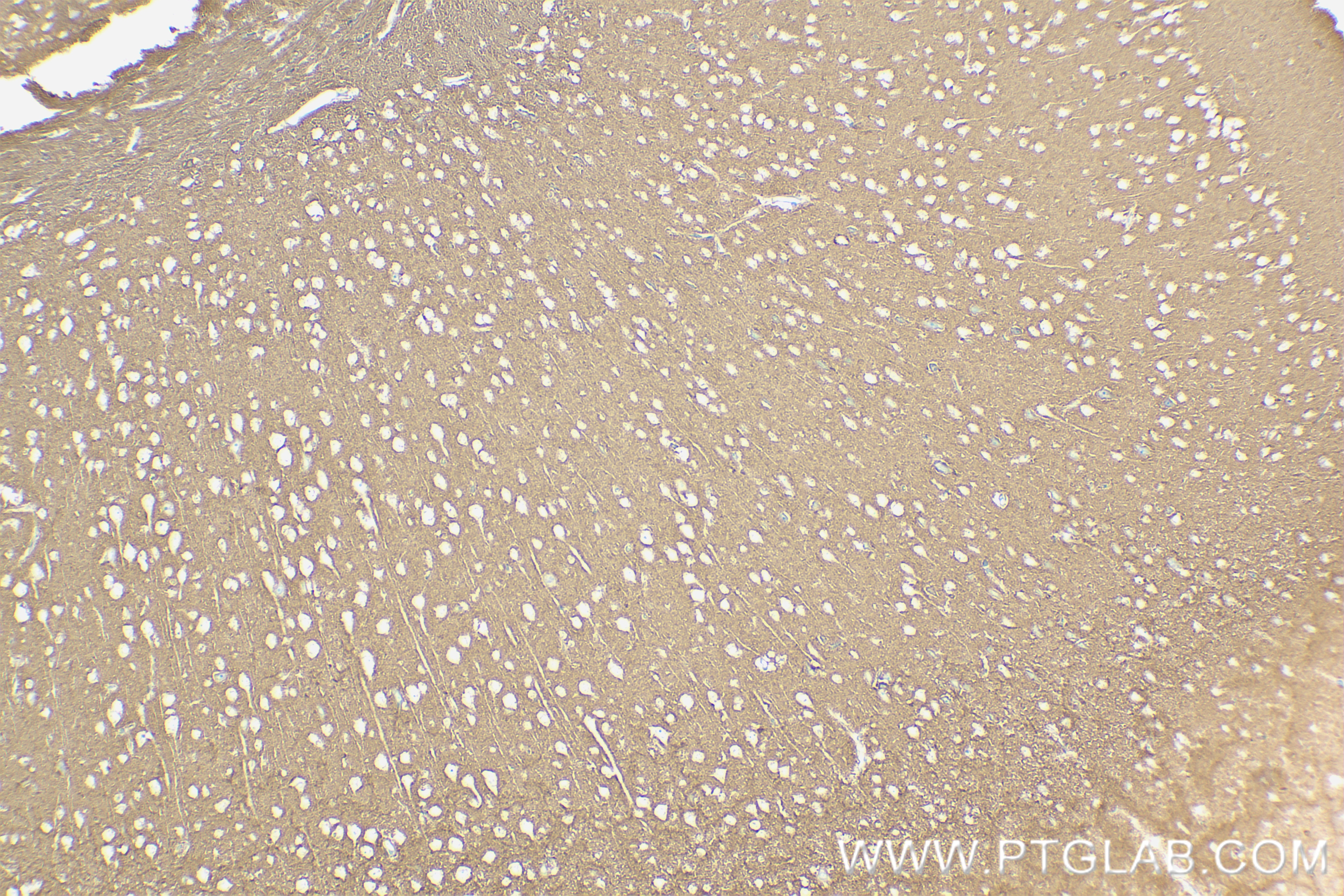Immunohistochemistry (IHC) staining of mouse brain tissue using NCAM1/CD56 Recombinant antibody (83883-5-RR)
