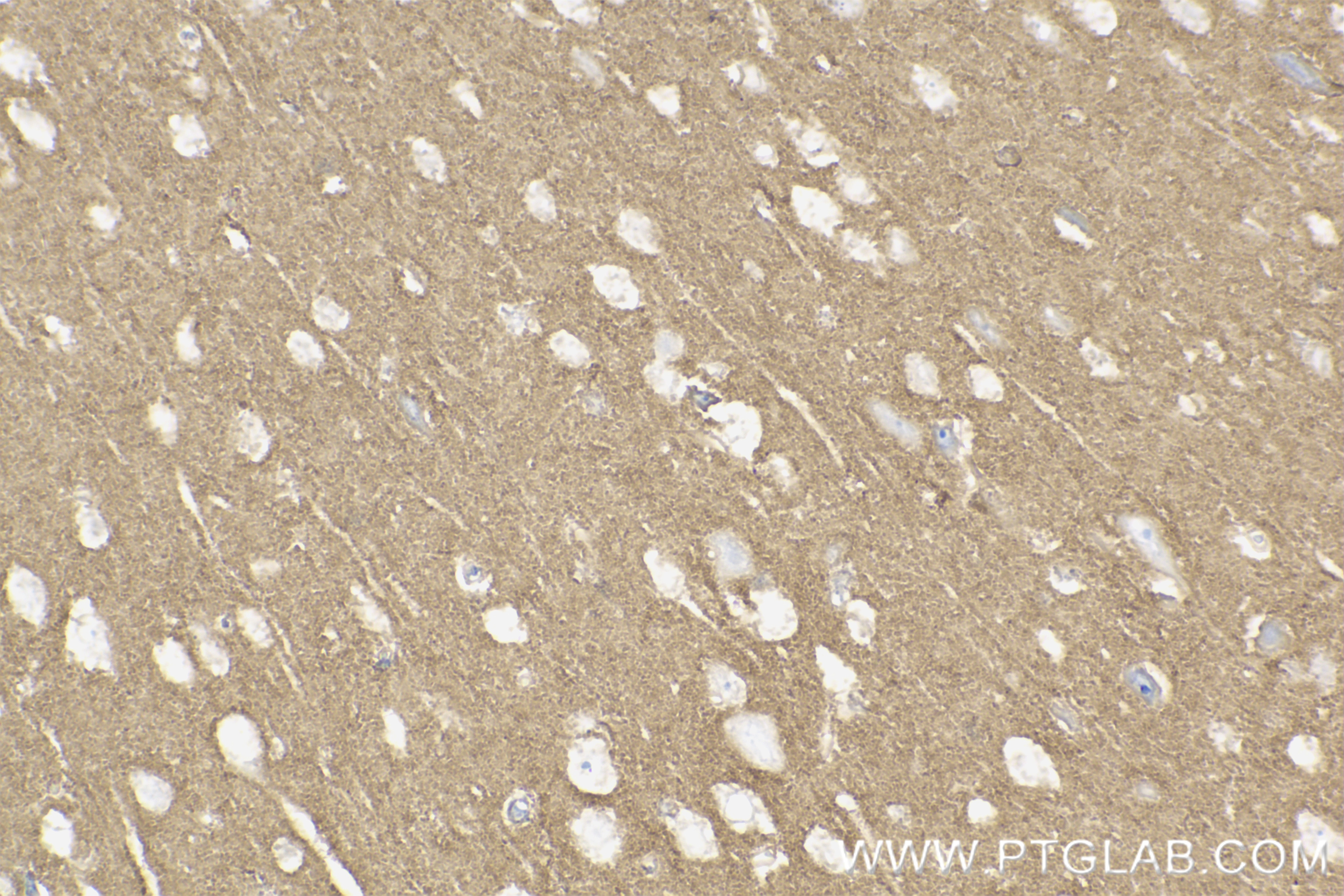 Immunohistochemistry (IHC) staining of mouse brain tissue using NCAM1/CD56 Recombinant antibody (83883-5-RR)