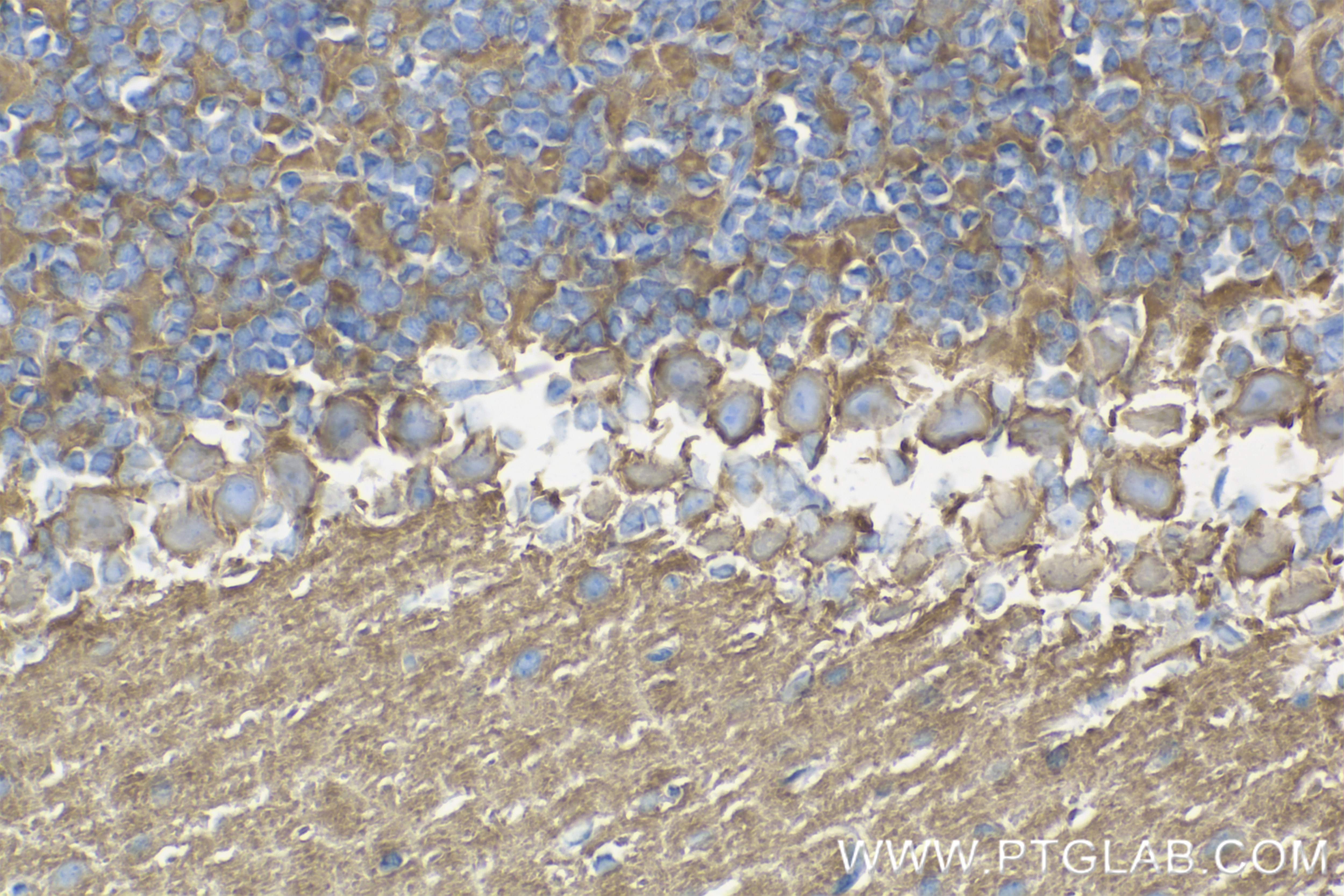 Immunohistochemistry (IHC) staining of mouse cerebellum tissue using NCAM1/CD56 Recombinant antibody (83883-5-RR)
