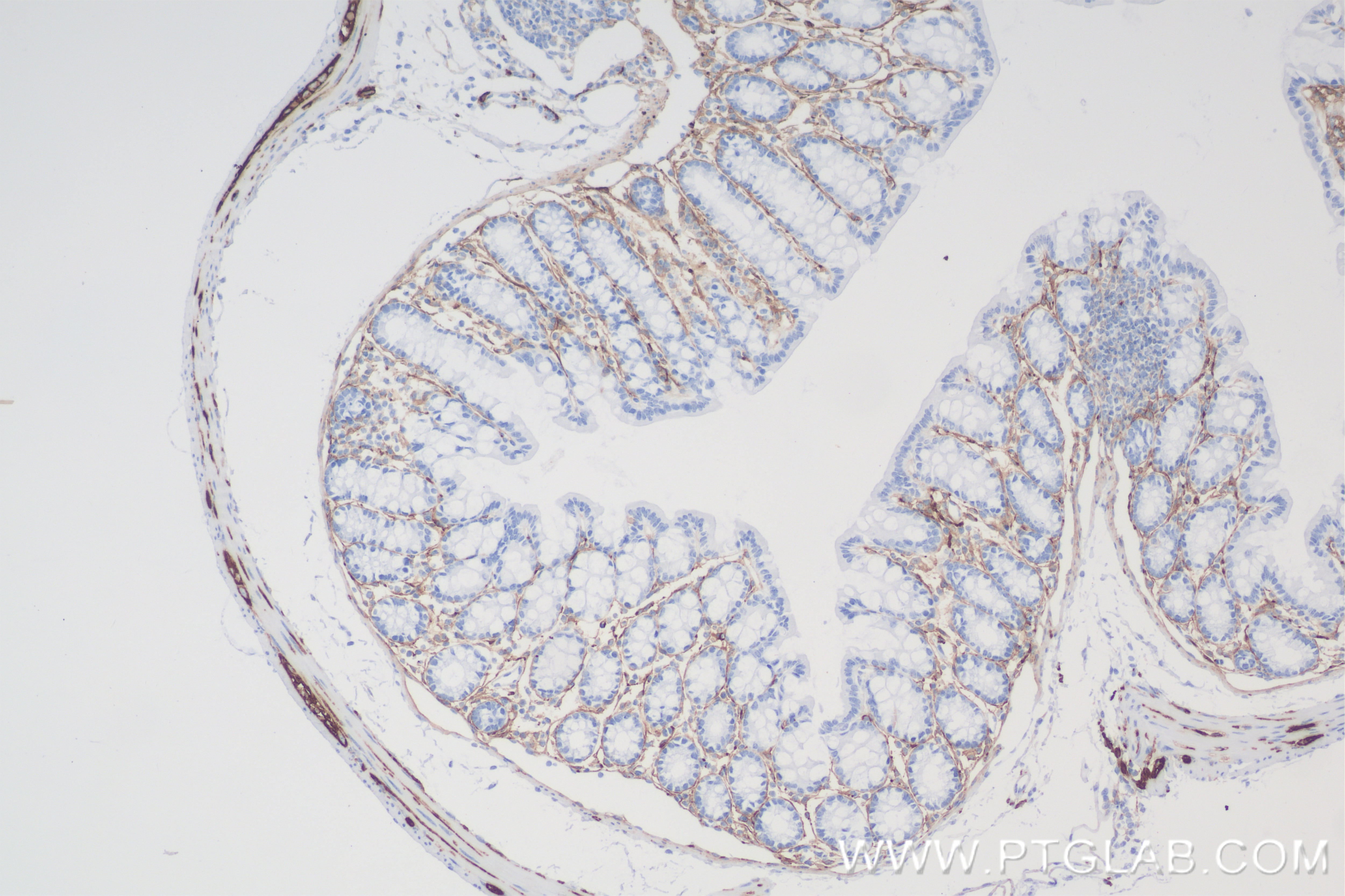 Immunohistochemistry (IHC) staining of mouse colon tissue using NCAM1/CD56 Recombinant antibody (83883-5-RR)