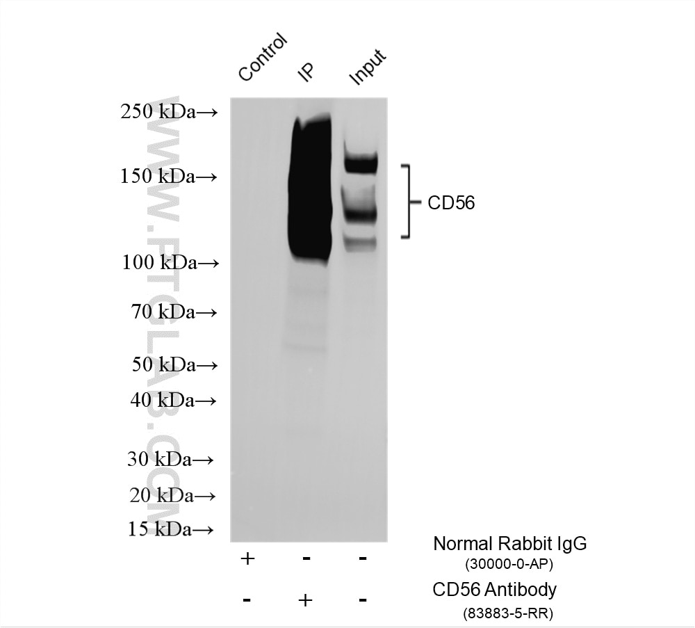 Immunoprecipitation (IP) experiment of mouse brain tissue using NCAM1/CD56 Recombinant monoclonal antibody (83883-5-RR)