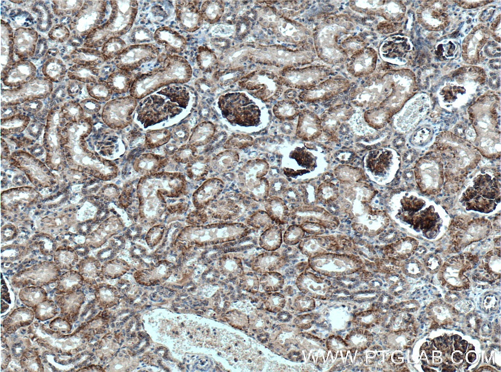 Immunohistochemistry (IHC) staining of human kidney tissue using Nectin-2/PVRL2 Polyclonal antibody (27171-1-AP)